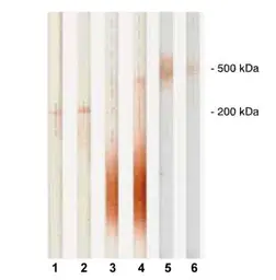 Anti-Pro-MBP / htPAPP-A antibody [11E4] used in Western Blot (WB). GTX14597
